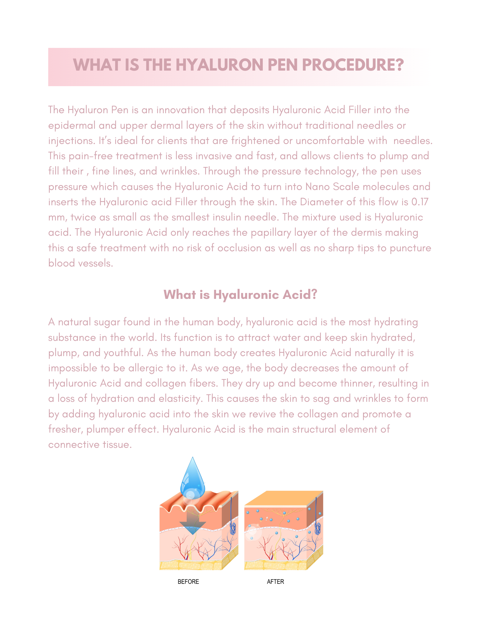 HYALURON PEN EBOOK